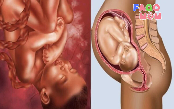 Những lưu y cho mẹ bầu biết về vị trí ngôi thai đảm bảo an toàn