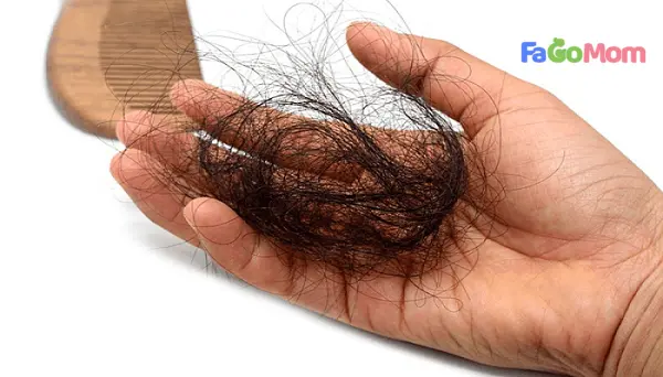 Rụng tóc sau sinh: Nguyên nhân, biện pháp phòng ngừa