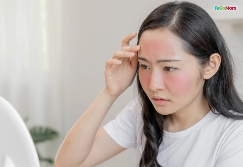 Nguyên tắc vàng khi chăm sóc da sau sinh