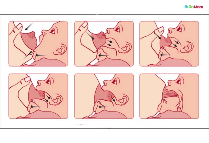 Các bước để có khớp ngậm đúng