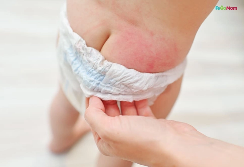 Khi nào cần đưa bé đi khám bác sĩ?