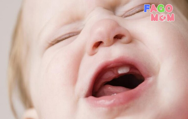 Trẻ sốt mọc răng: Nguyên nhân và dấu hiệu nhận biết