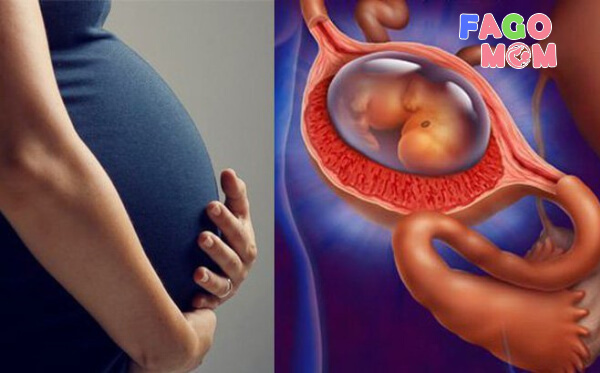 Nhận biết và khắc phục tình trạng có thai ngoài tử cung