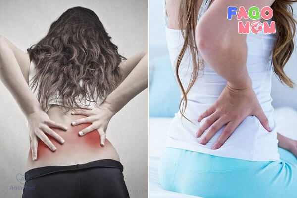 Dấu hiệu bị đau lưng sau sinh mổ