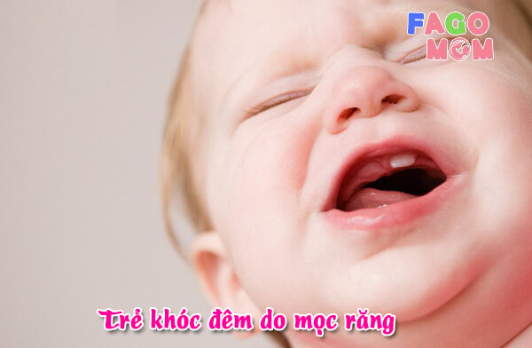 Mọc răng là nguyên nhân dẫn đến trẻ quấy khóc đêm