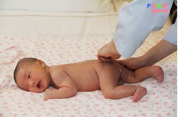 Rò hậu môn ở trẻ sơ sinh: Dấu hiệu nhận biết, cách điều trị