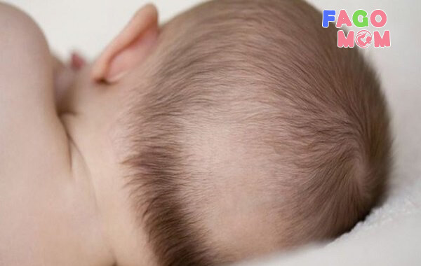 Hiện tượng rụng tóc ở trẻ sơ sinh