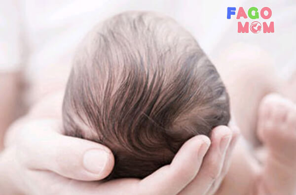 Rụng tóc ở trẻ do dùng quá nhiều hóa chất