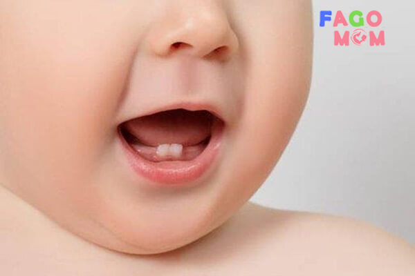 Mẹ chú ý cách chăm sóc răng sữa của trẻ