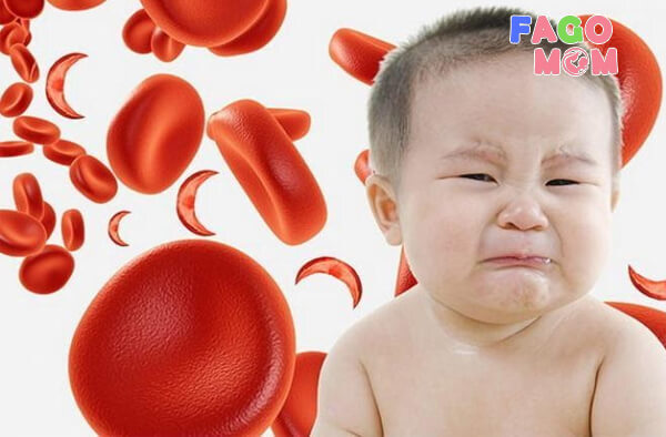 Trẻ thiếu máu kèm các dấu hiệu bất thường nên cho trẻ đi khám bác sĩ