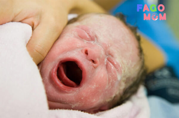 Bệnh màng trong ở trẻ sơ sinh