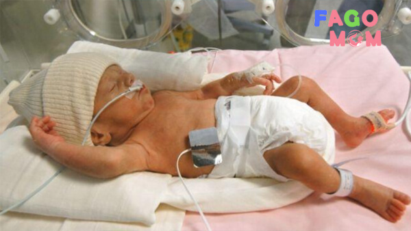 Tình trạng suy hô hấp cấp xảy ra khoảng 6 giờ đầu sau khi sinh