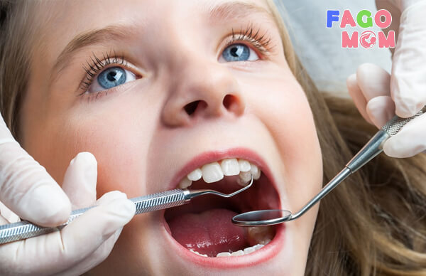Trẻ nghiến răng khi ngủ nếu không chữa trị sẽ làm ảnh hưởng chất lượng men răng