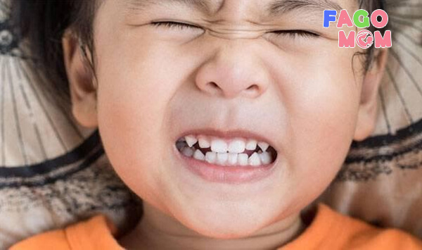 Việc nghiến răng nặng ở trẻ dẫn đến nhiều tác hại