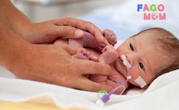 Một số yếu làm trẻ sơ sinh bị mắc bệnh nhiễm trùng máu