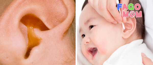 Nguyên nhân dẫn đến nhiễm trùng tai rất nặng ở trẻ sơ sinh