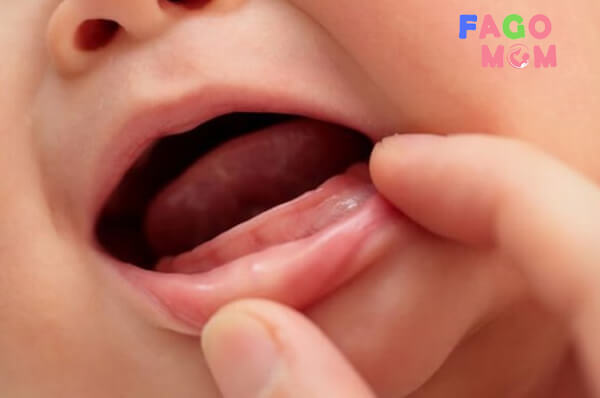  Dấu hiệu nhận biết trẻ mọc răng